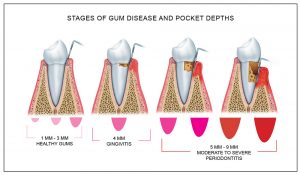 Gum Exam